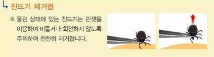 여주시, 진드기 매개질환 예방이 최선 !!!