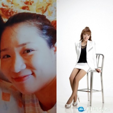 연예인 최고의 성형미인은?