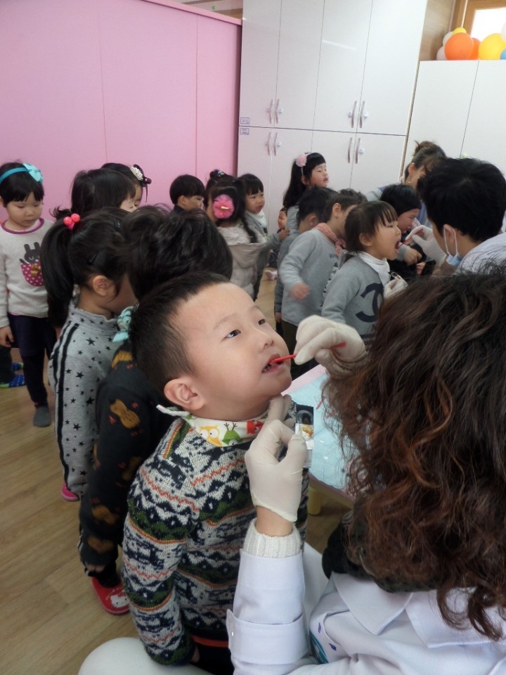 어린이충치 불소도포로 막는다
